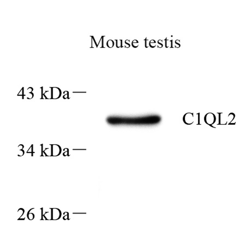 Anti -C1QL2 Rabbit pAb