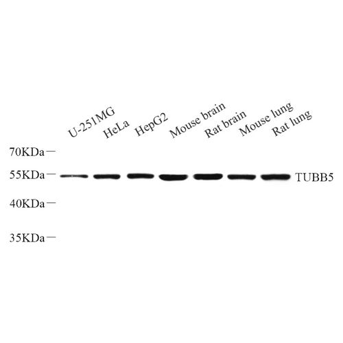 Anti -beta Tubulin Rabbit pAb