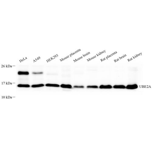 Anti -DDX3Y Rabbit pAb