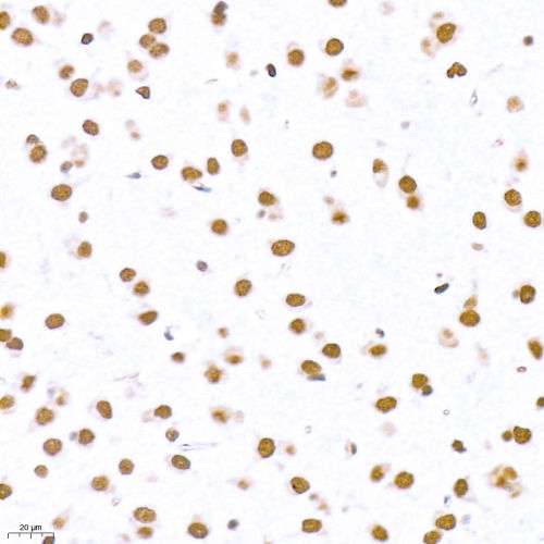 Anti -Topoisomerase II alpha Rabbit pAb